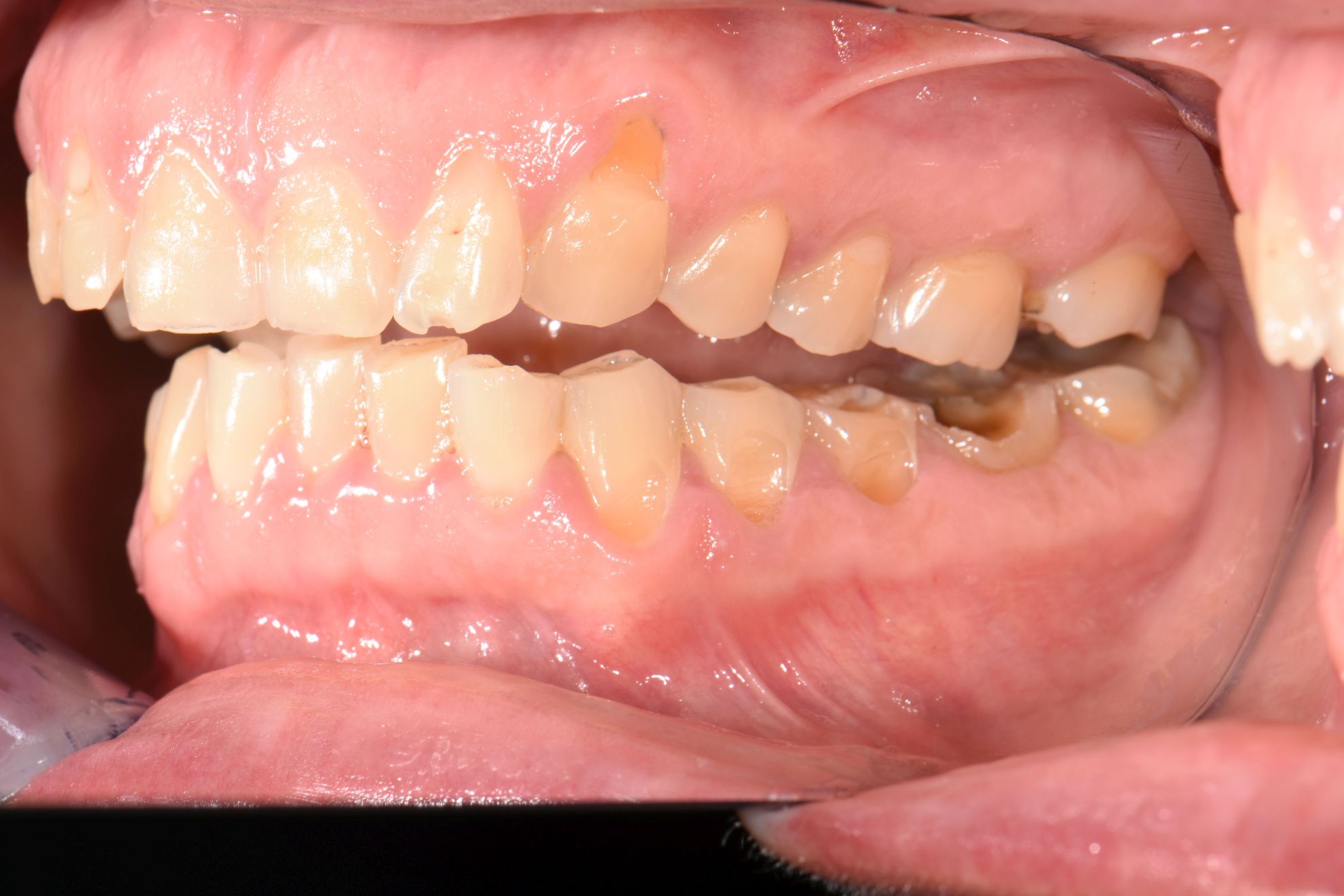 composite reconstruction before.jpg