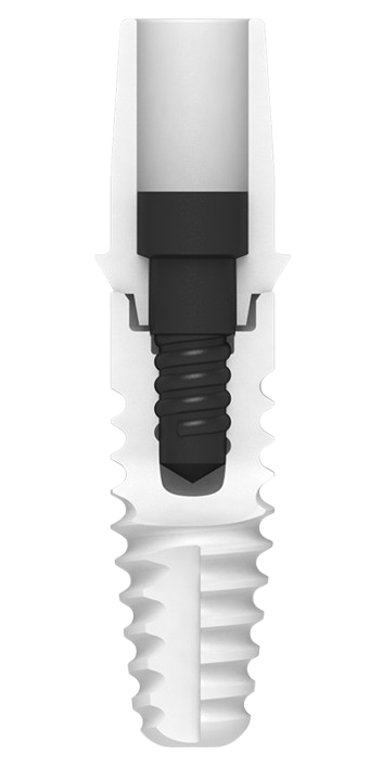 NobelPearl and Zeramex XT ceramic implant